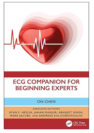 ECG