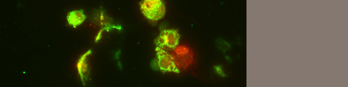 Immunofluorescent images of A431 Melanoma cells using MitoTracker Green FM and MitoTracker Red CMXRos