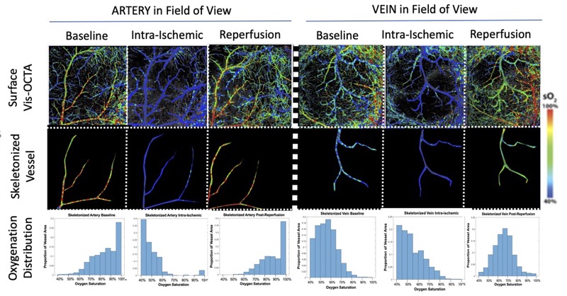 Optical imaging of mouse vasculature