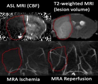 Laser Speckle, MRI and  TTC of a stroke Image 2