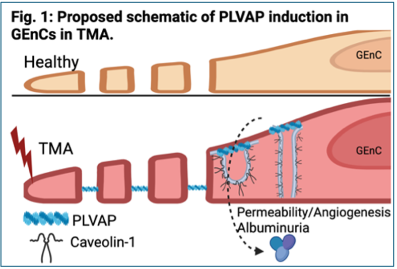 figure 1 PLVAP