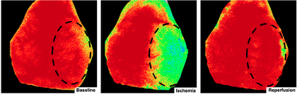 Laser Speckle of I/R Laser Speckle of I/R