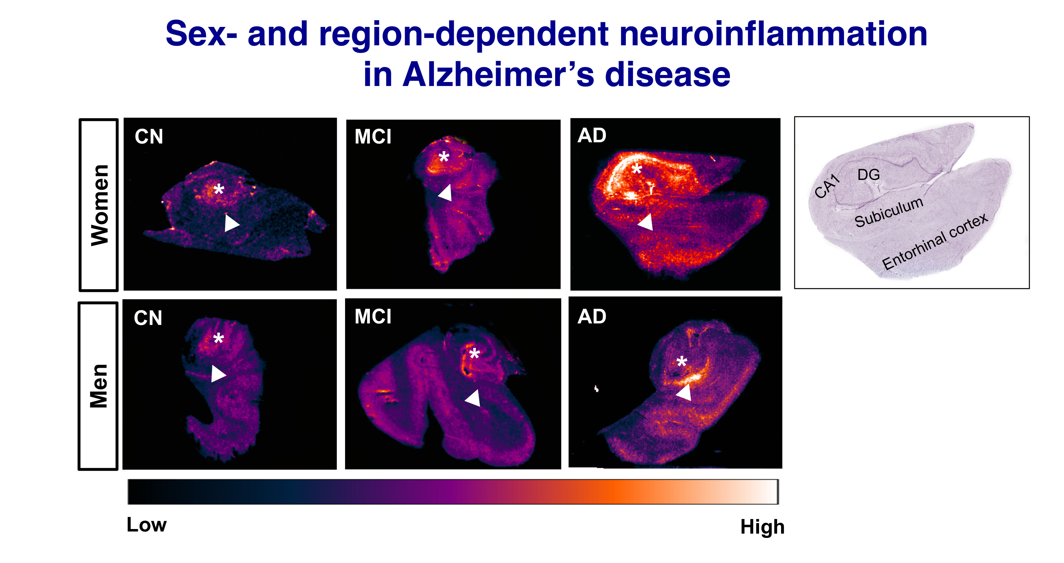 Image titled Sex- and region-dependent neuroinflammation in Alzheimer's disease Image titled Sex- and region-dependent neuroinflammation in Alzheimer's disease