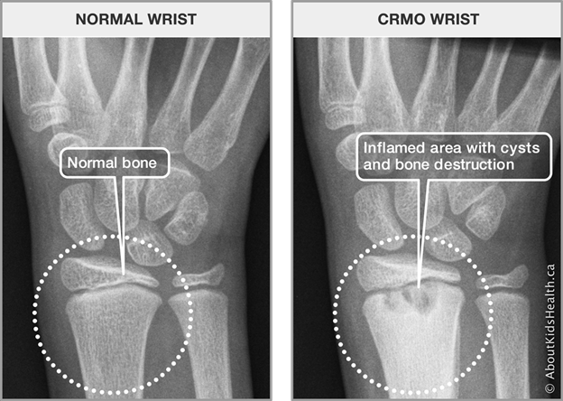 Representative Imaging Findings in CNO